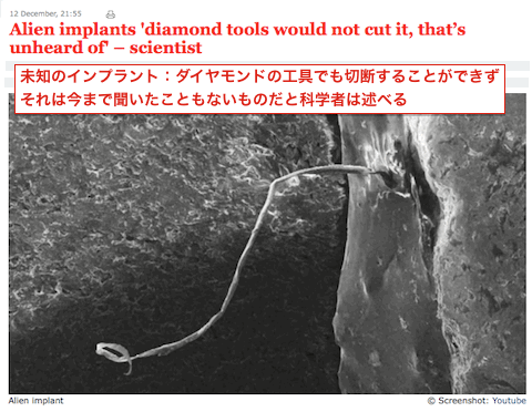 alien-implant.gif