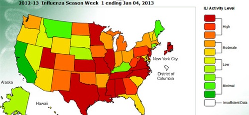 flu-11.jpg